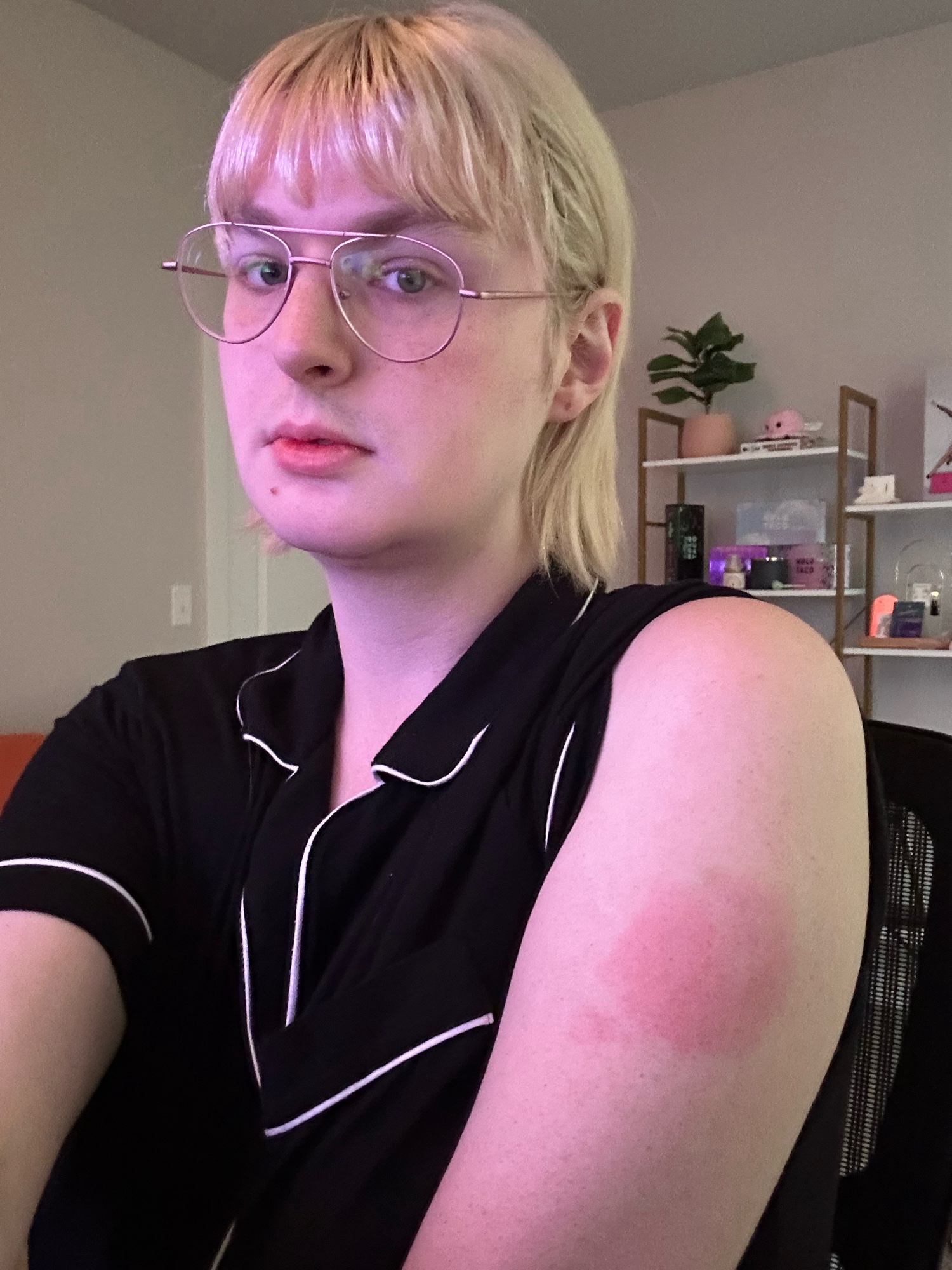 skylar, a blonde woman with bangs sitting at her desk, left arm exposed. there’s a large red spot on her upper arm from vaccines, and she has a neutral expression from the discomfort.